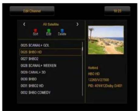 Ferguson Ariva 253Combo - Comment supprimer une chaine? - 1
