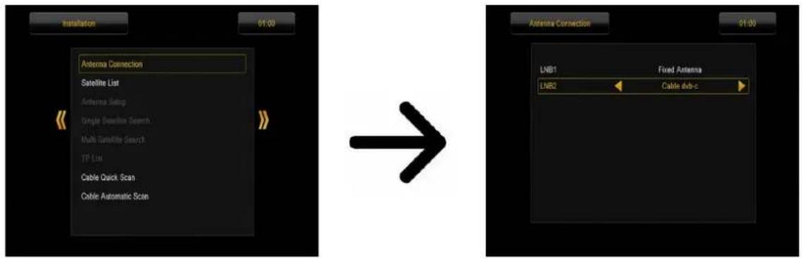 Ferguson Ariva 203 - Télévision par câble (uniquement pour les modèles 153 combo et 253COMBO) - 1