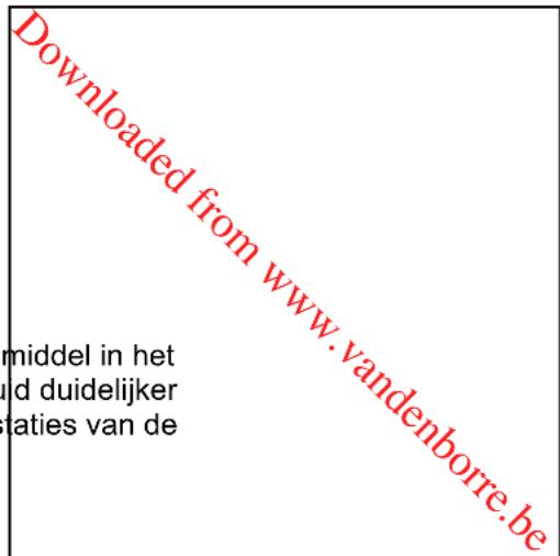 PROLINE PBF55W - SNORREND, PULSEREND GELUID - 1