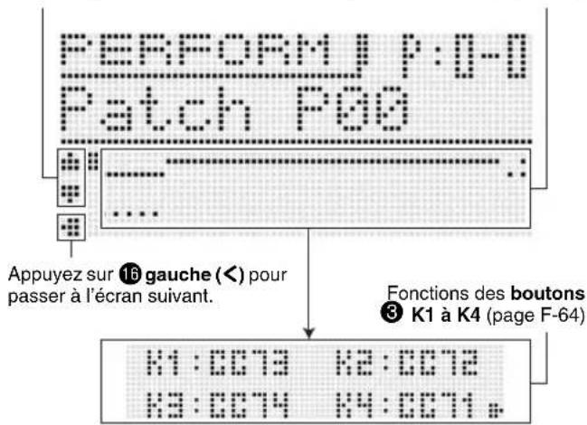 CASIO XWP1 - Appuyez sur 7 PERFORM. - 1