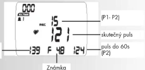 KETTLER Golf M - Poznanka: - 3