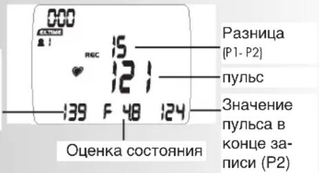 KETTLER Unix MX - Примечание: - 4