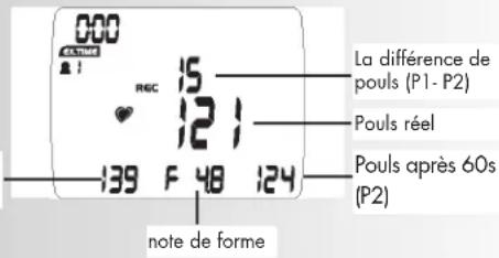 KETTLER Unix MX - Note: - 4