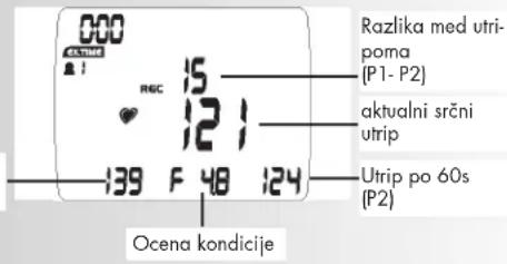 KETTLER Unix MX - Opomba: - 4