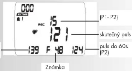 KETTLER Unix MX - Poznámka: - 4