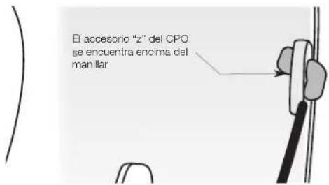 MASPORT 660 RRR - CONEXION DE LOS CABLES - 5