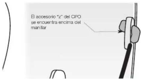 MASPORT 500 RRR - CONEXION DE LOS CABLES - 5