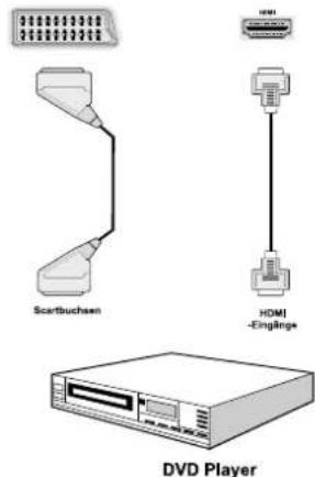 SCHAUB LORENZ 26LT30 - Anschluss eines DVD-Players - 1