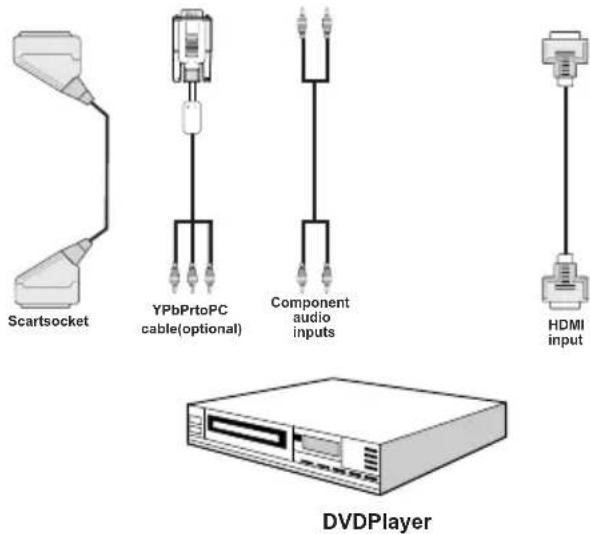 MANHATTAN MT2211DVX12 - Connecting to a DVD Player - 1