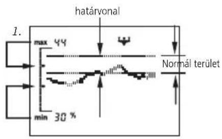 SOEHNLE Body Balance Slim FT5 - Várható állapot kijelzése - 1
