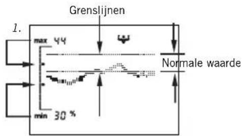 SOEHNLE Body Balance Slim FT5 - Trendindicatie - 1