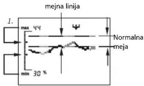 SOEHNLE Body Balance Slim FT5 - Prikaz trenda - 1