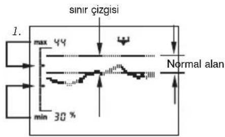 SOEHNLE Body Balance Slim FT5 - Gelişme göstergesi - 1