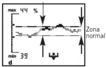 SOEHNLE Body Balance Comfort FS5 - Indicação de tendência - 1
