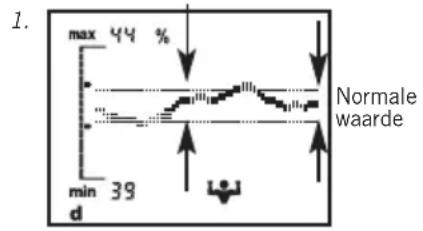 SOEHNLE Body Balance Comfort FS5 - Trendindicatie - 1