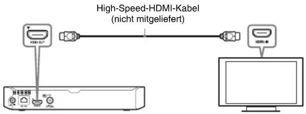 SONY BDPS3700 - Anschlieben an Ihr Fernsehgerät - 1