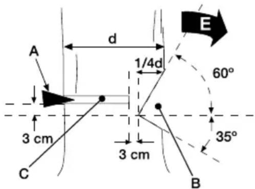 GARLAND Bulk First E - 7.3.1.ABBATTIMENTO DI UN ALBERO - 2