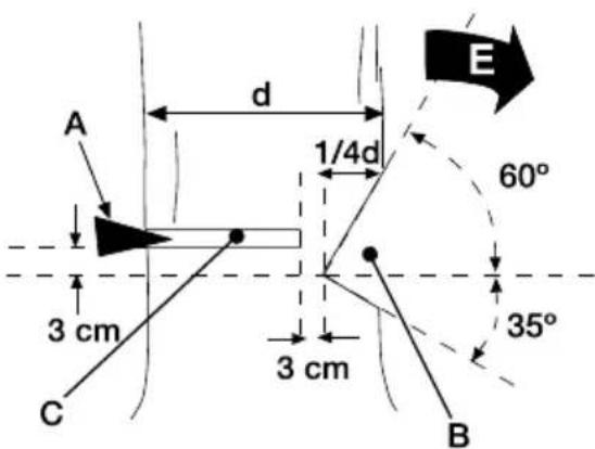 GARLAND Bulk 518 E - FELLING A TREE - 2