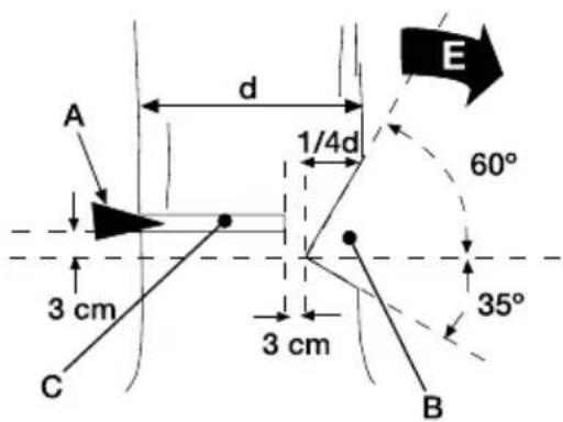 GARLAND Bulk 518 E - ABBATTIMENTO DI UN ALBERO - 2