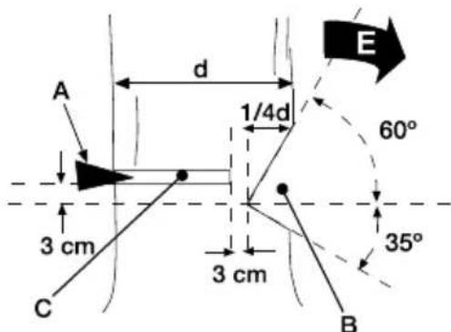 GARLAND Bulk 316 E - 7.3.1.ABATTRE UN ARBRE - 2