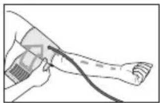 BEURER BM 95 - Colocar el brazalete - 2