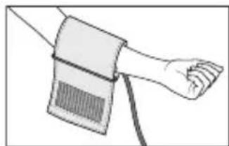 BEURER BM 95 - Applicazione del manicotto - 1