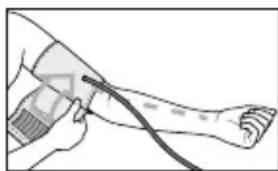 BEURER BM 65 - Colocar el brazalete - 2