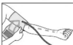 BEURER BM 77 - Colocar el brazalete - 2