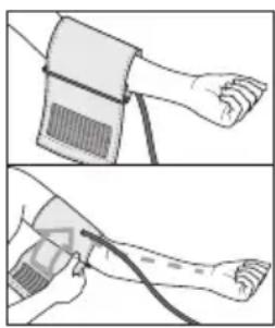 BEURER BM 77 - Zakladanie mankietu - 1