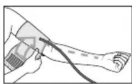 SANITAS SBM 19 - Measuring blood pressure Positioning cuff - 2