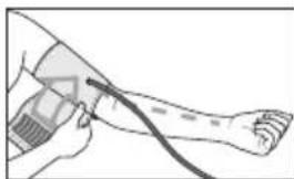 SANITAS SBM 21 - Applicare il bracciale - 2