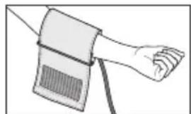 SANITAS SBM 38 - Applicazione del manicotto - 1