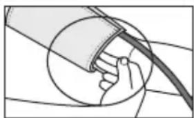 SANITAS SBM 42 - Applicazione del manicotto - 3