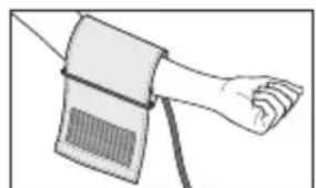 SANITAS SBM 42 - Applicazione del manicotto - 1
