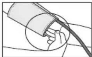 SANITAS SBM 20 - Fixing the cuff - 3