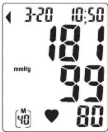 INOVALLEY 0098N - Recalling data: - 1