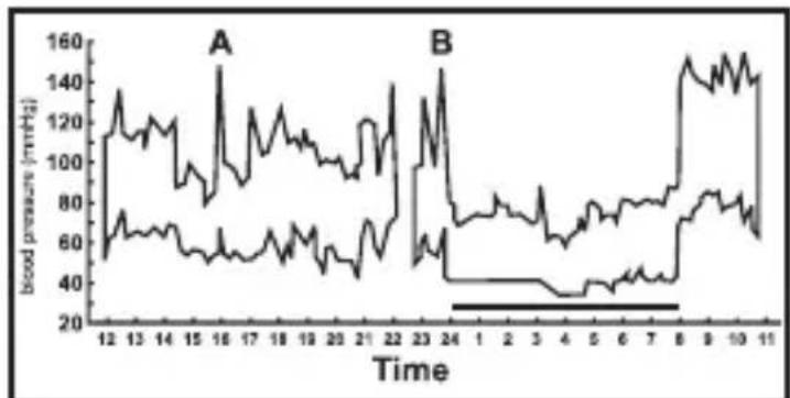 INOVALLEY 0098N - Variations in blood pressure - 1