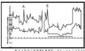 ELTA BM122 - CUAL ES LA RAZON PARA REALIZAR MEDICIONES DE PRESION SANGUINEA EN CASA? - 2