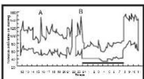 ELTA BM122 - Variations de la tension arterielle - 2