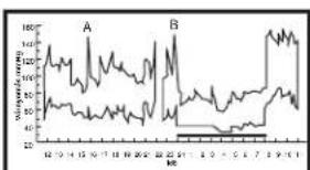 ELTA BM122 - A vénnyománs ingadozásal - 2