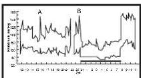 ELTA BM122 - Schwankungen des Blutdrucks - 2