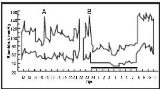 ELTA BM101 - Schommelingen van de bloeddruk - 2