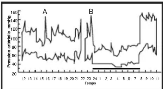 ELTA BM101 - Variations de la tension arterielle - 2