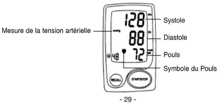 ELTA BM101 - DESCRIPTION DE L'APPAREIL - 3