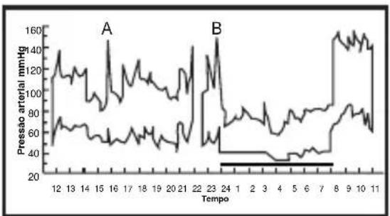 ELTA BM101 - Variações da tensão arterial - 2