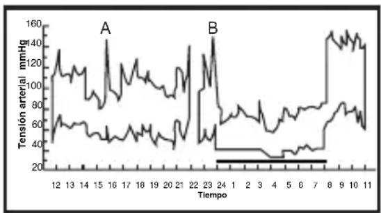 ELTA BM101 - Fluctuaciones de la tensión - 2