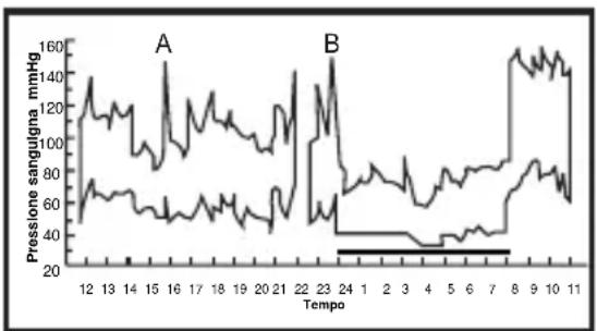 ELTA BM101 - Oscillazioni della pressione sanguigna - 2