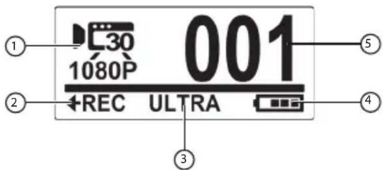 MEDION Life S47018 - OLED-Display - 1