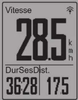 Bryton Rider 330 - REMARQUE : - 3