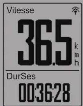 Bryton Rider 330 - REMARQUE : - 1